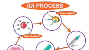 Read more about the article Why Infertility Common Nowadays and IUI Treatment at Kiranmayee Clinic, Hyderabad