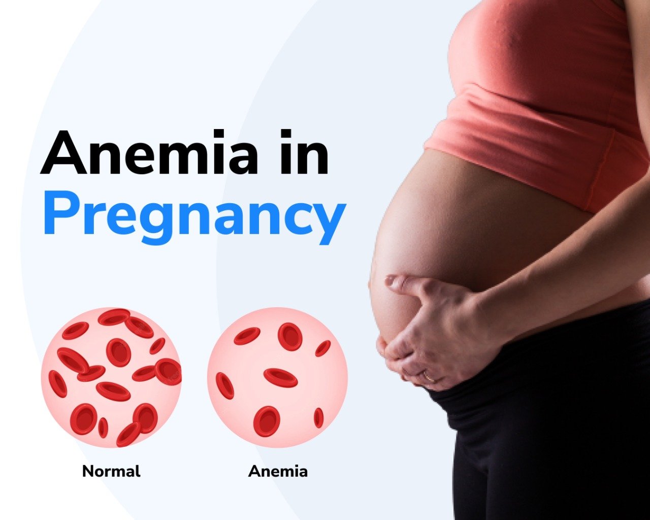 Read more about the article Anemia During Pregnancy And Risks